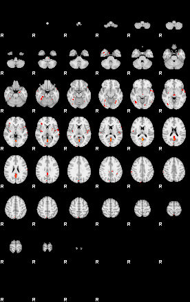 Patients 29012 118