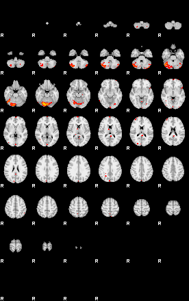 Patients 29741 66