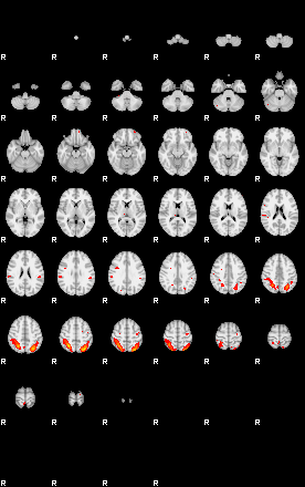 Patients 29171 32