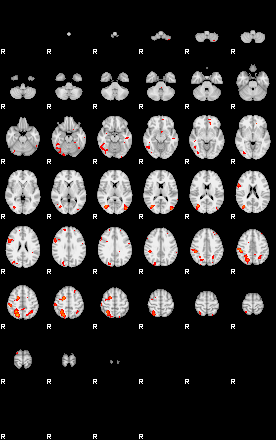 Patients 29181 136