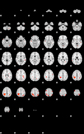 Patients 29191 64