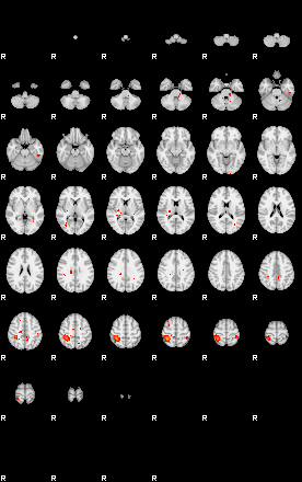 Patients 29201 90