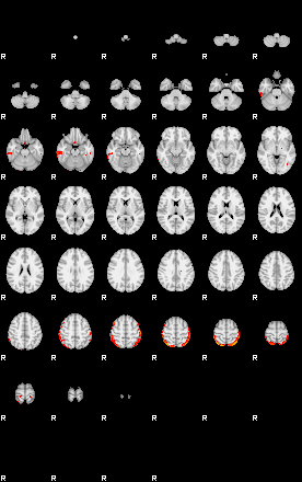 Patients 29291 135