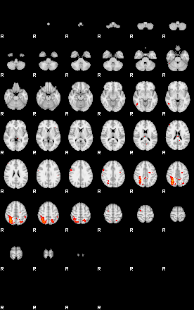 Patients 29410 21