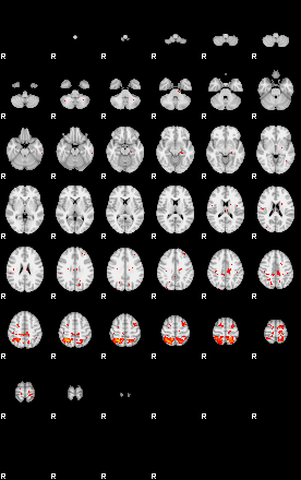 Patients 29413 138