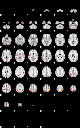 Patients 29541 99