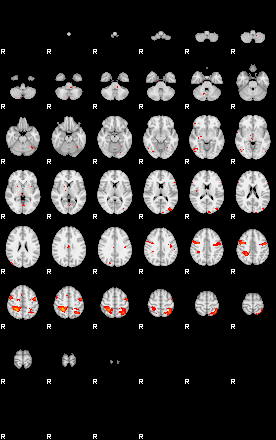 Patients 29794 99