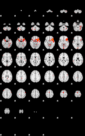 Patients 28802 1