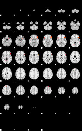 Patients 29153 6