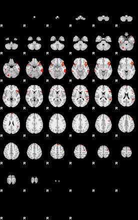 Patients 29175 39