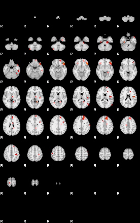 Patients 29203 16