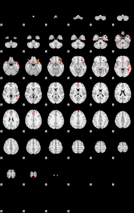 Patients 29275 6