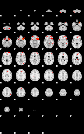 Patients 29509 33