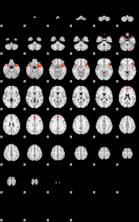 Patients 29657 33