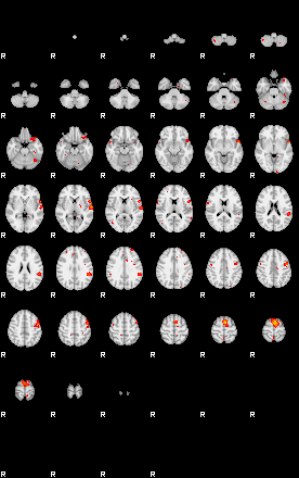 Patients 29113 120