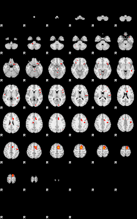 Patients 29162 1