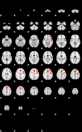 Patients 29165 192