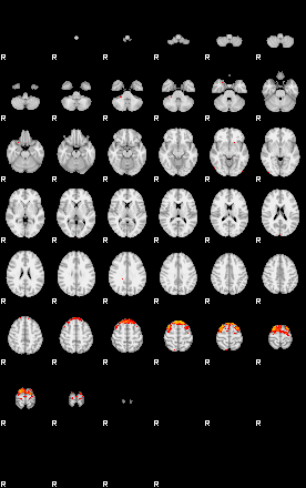 Patients 29391 135