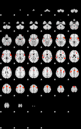 Patients 29400 161