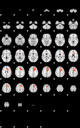 Patients 29410 5