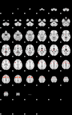 Patients 29503 30