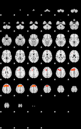 Patients 29514 14