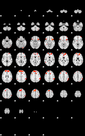 Patients 29030 94