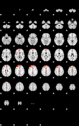 Patients 29667 6