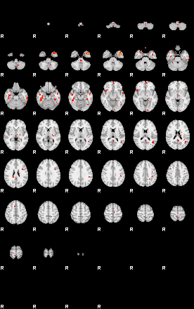 Patients 28690 3