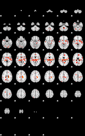 Patients 28799 193