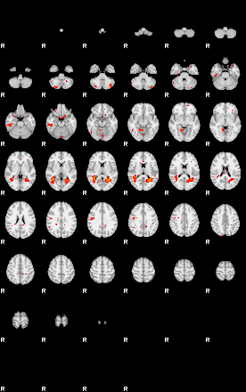 Patients 28818 193