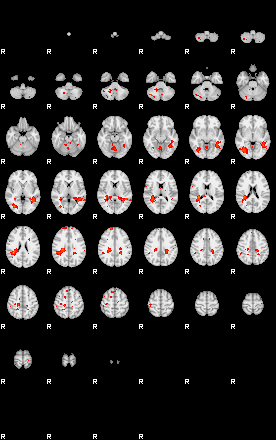 Patients 28839 198