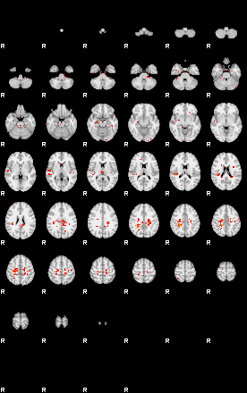 Patients 28933 13