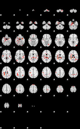 Patients 28940 187