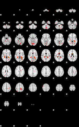 Patients 29008 92