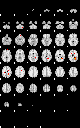 Patients 29029 165