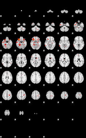 Patients 29058 22