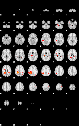 Patients 29100 140