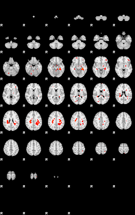 Patients 29151 153