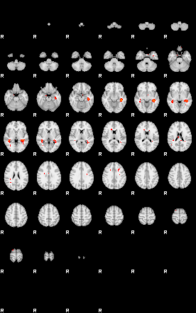 Patients 29161 38