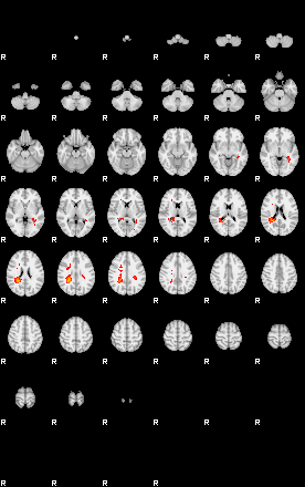 Patients 29161 6