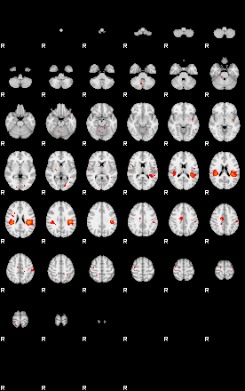 Patients 29174 52