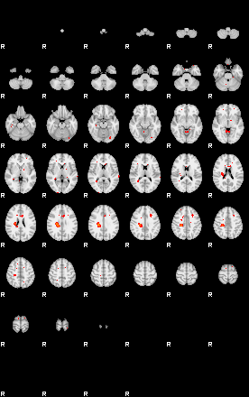 Patients 29175 180