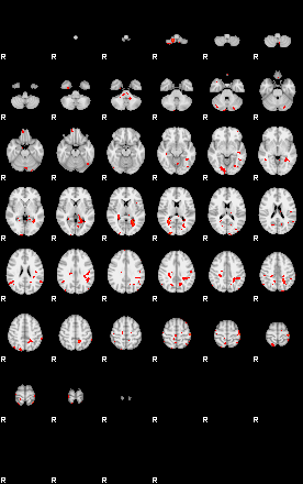 Patients 29179 130