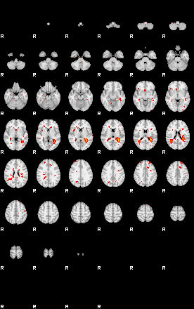 Patients 29183 174