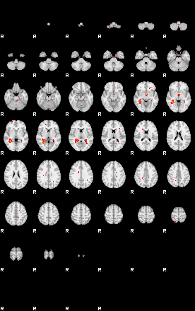 Patients 29184 85