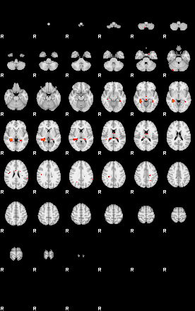 Patients 29185 92