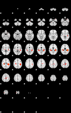 Patients 29189 112