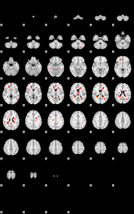 Patients 29200 81