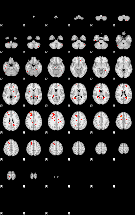 Patients 29205 179